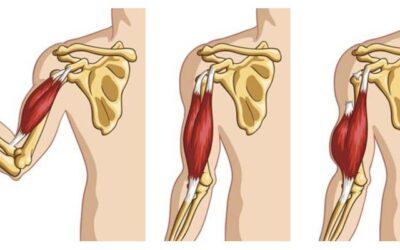 Tendinitis porción larga bíceps braquial: Síntomas, causas, diagnóstico y tratamiento