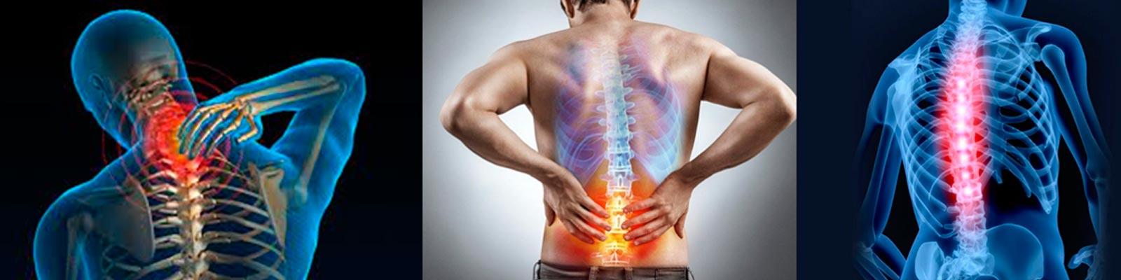 Patologías de la columna vertebral ¿cómo prevenir el dolor?