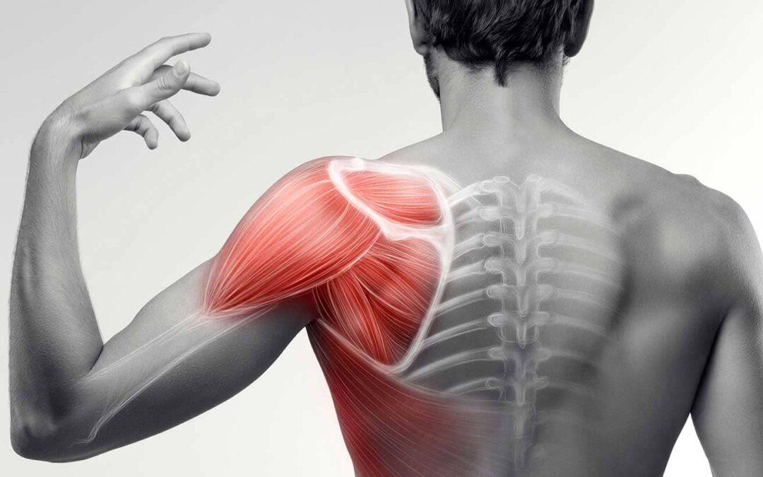 Rehabilitaci n Para Lesiones De Hombro WXSPZZ Rehabilitaci n Para Lesiones De Hombro WXSPZZ